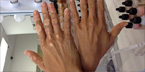 Cover Vitiligo with Makeup